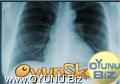 X -ray play games